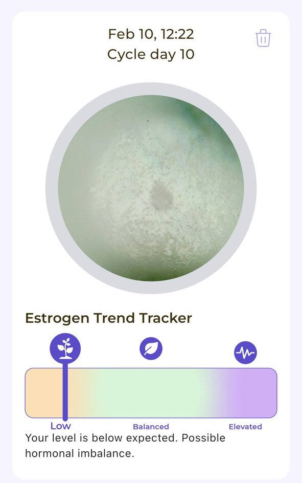 Ovul cycle tracking app screenshot showing estrogen trend tracker with low estrogen level and possible hormonal imbalance on cycle day 10